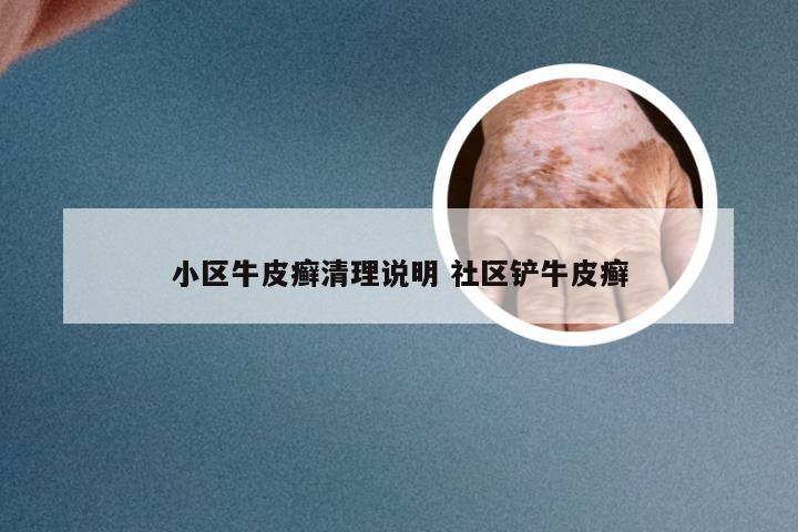小区牛皮癣清理说明 社区铲牛皮癣