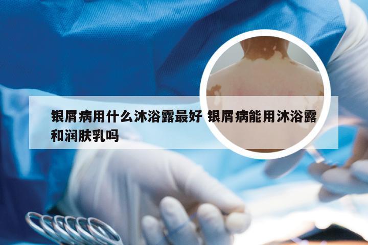 银屑病用什么沐浴露最好 银屑病能用沐浴露和润肤乳吗