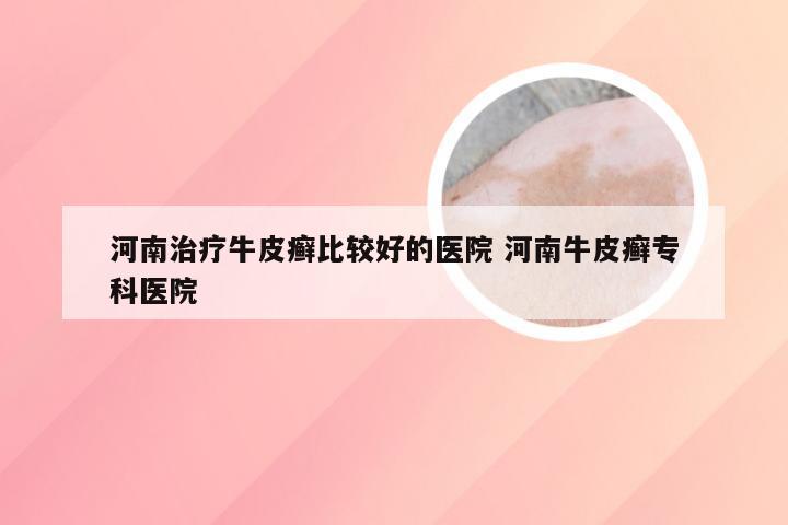 河南治疗牛皮癣比较好的医院 河南牛皮癣专科医院