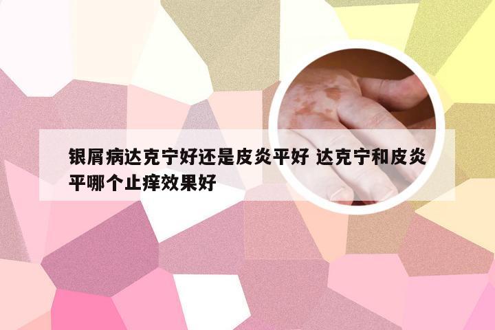 银屑病达克宁好还是皮炎平好 达克宁和皮炎平哪个止痒效果好