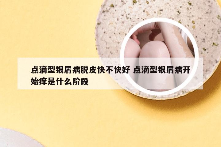 点滴型银屑病脱皮快不快好 点滴型银屑病开始痒是什么阶段