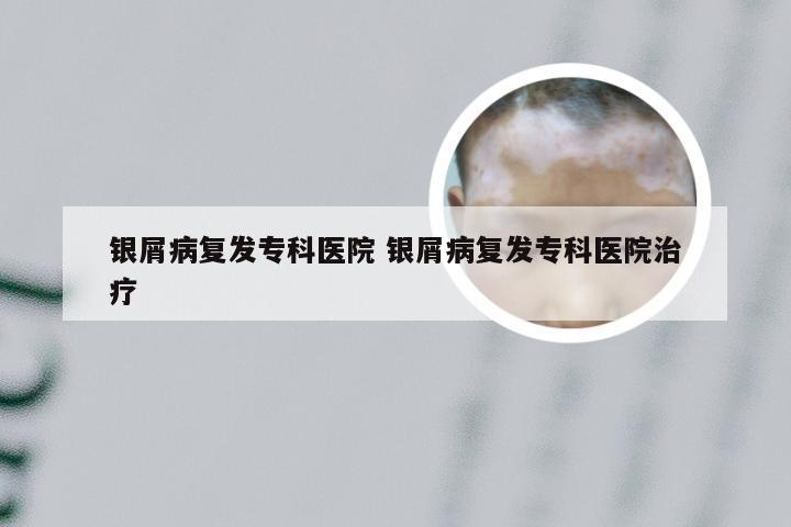 银屑病复发专科医院 银屑病复发专科医院治疗
