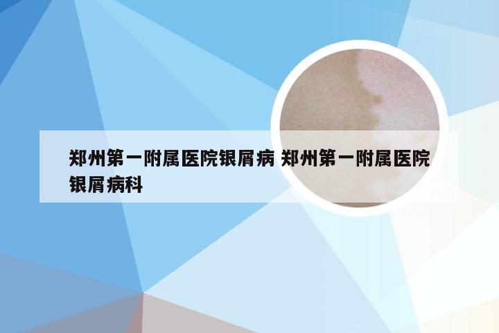 郑州第一附属医院银屑病 郑州第一附属医院银屑病科