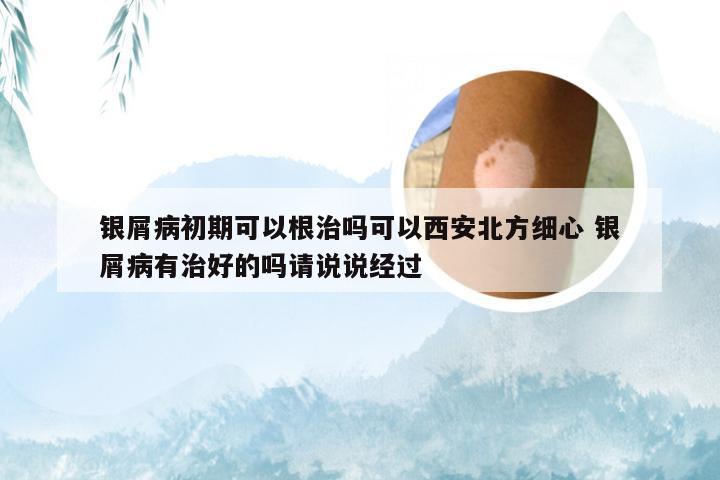 银屑病初期可以根治吗可以西安北方细心 银屑病有治好的吗请说说经过