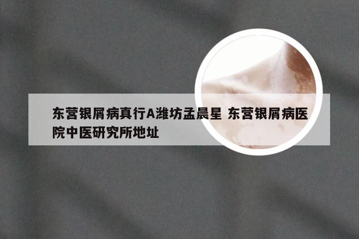 东营银屑病真行A潍坊孟晨星 东营银屑病医院中医研究所地址