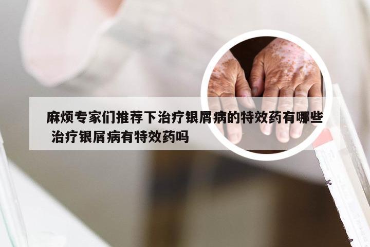麻烦专家们推荐下治疗银屑病的特效药有哪些 治疗银屑病有特效药吗