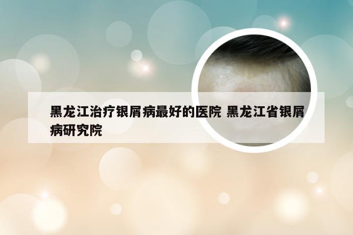 黑龙江治疗银屑病最好的医院 黑龙江省银屑病研究院