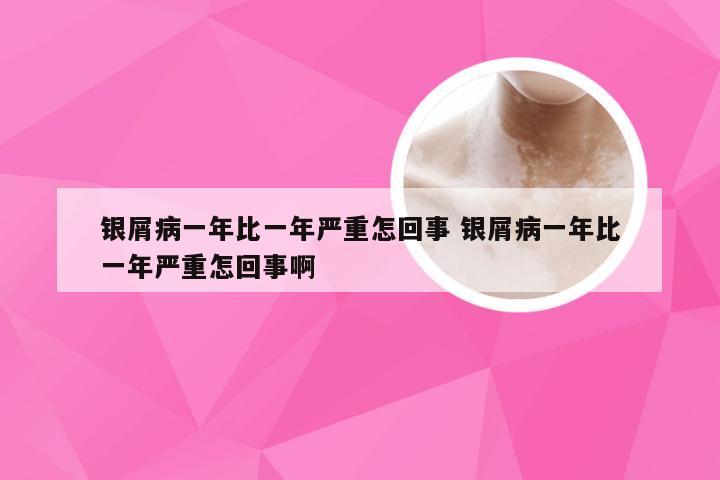 银屑病一年比一年严重怎回事 银屑病一年比一年严重怎回事啊