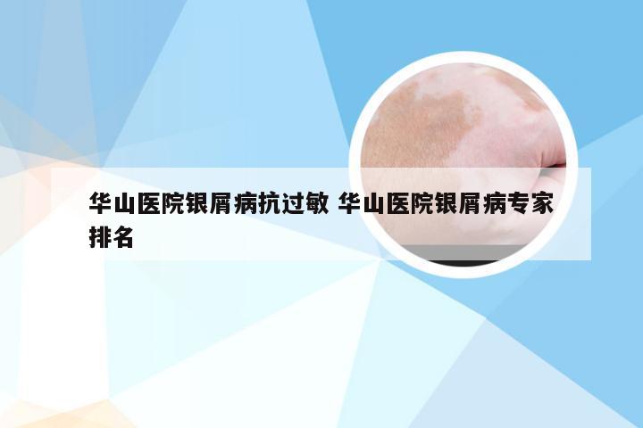 华山医院银屑病抗过敏 华山医院银屑病专家排名