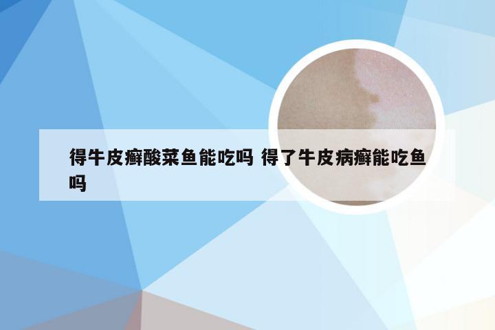 得牛皮癣酸菜鱼能吃吗 得了牛皮病癣能吃鱼吗