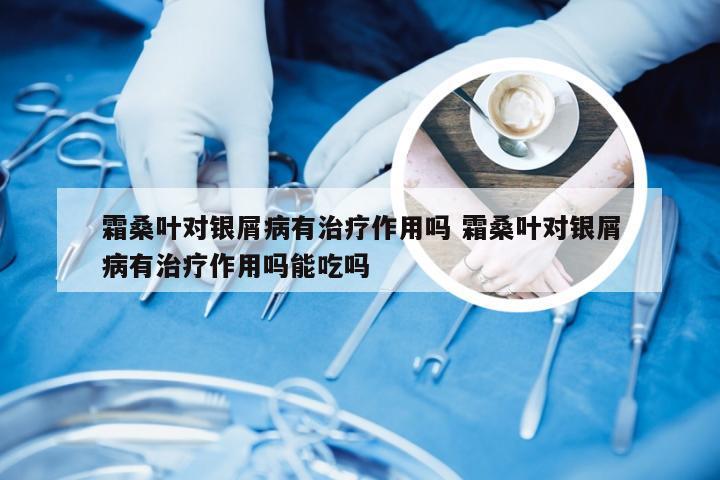 霜桑叶对银屑病有治疗作用吗 霜桑叶对银屑病有治疗作用吗能吃吗
