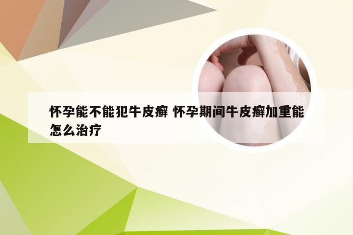 怀孕能不能犯牛皮癣 怀孕期间牛皮癣加重能怎么治疗
