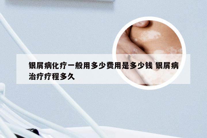 银屑病化疗一般用多少费用是多少钱 银屑病治疗疗程多久