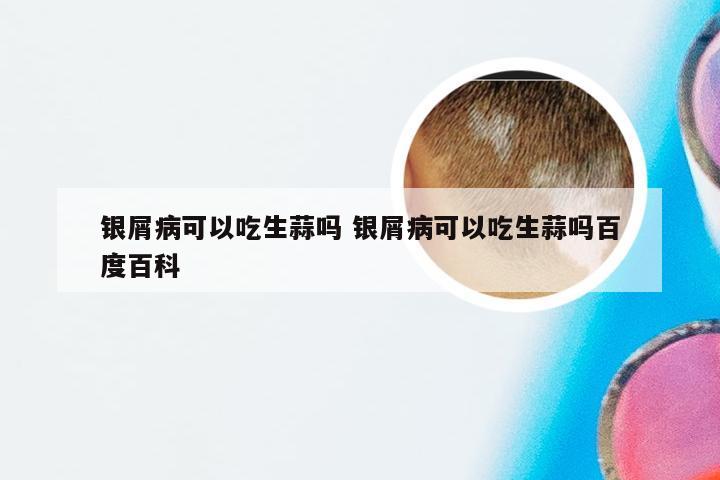 银屑病可以吃生蒜吗 银屑病可以吃生蒜吗百度百科