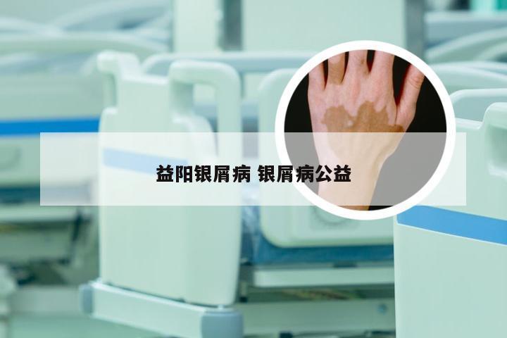 益阳银屑病 银屑病公益