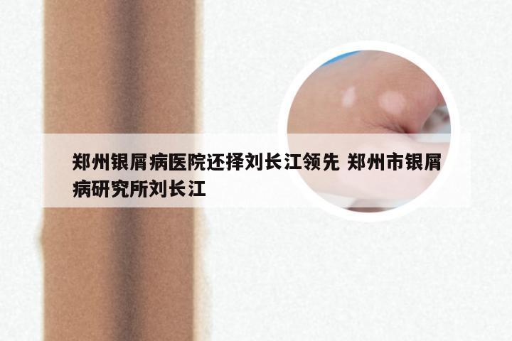 郑州银屑病医院还择刘长江领先 郑州市银屑病研究所刘长江