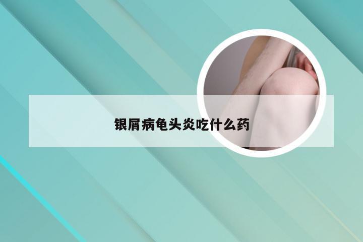 银屑病龟头炎吃什么药