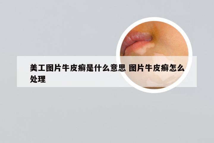 美工图片牛皮癣是什么意思 图片牛皮癣怎么处理
