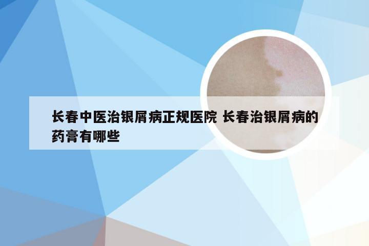 长春中医治银屑病正规医院 长春治银屑病的药膏有哪些