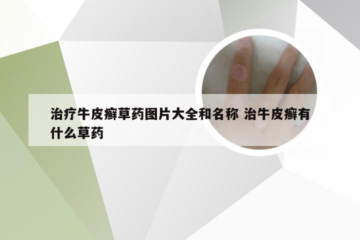 治疗牛皮癣草药图片大全和名称 治牛皮癣有什么草药
