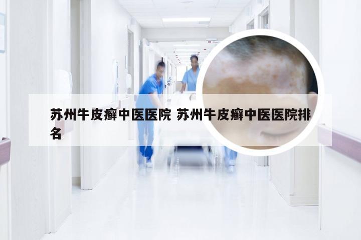 苏州牛皮癣中医医院 苏州牛皮癣中医医院排名