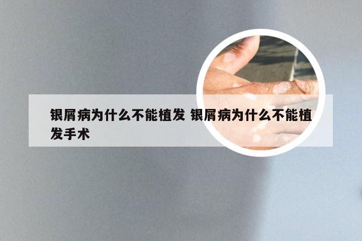 银屑病为什么不能植发 银屑病为什么不能植发手术