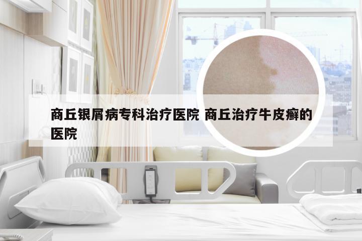 商丘银屑病专科治疗医院 商丘治疗牛皮癣的医院