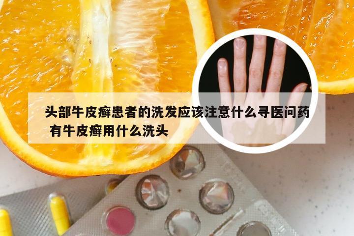 头部牛皮癣患者的洗发应该注意什么寻医问药 有牛皮癣用什么洗头