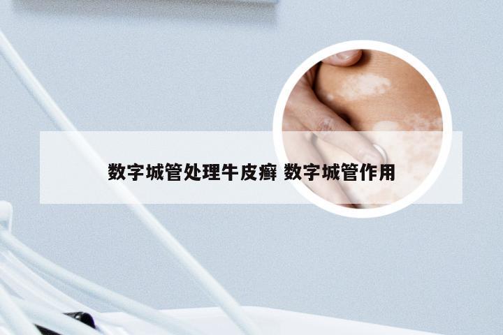 数字城管处理牛皮癣 数字城管作用