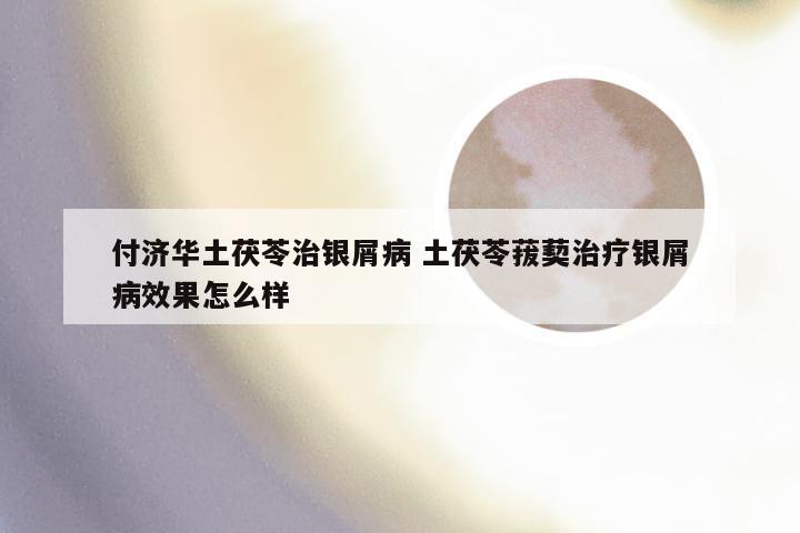 付济华土茯苓治银屑病 土茯苓菝葜治疗银屑病效果怎么样