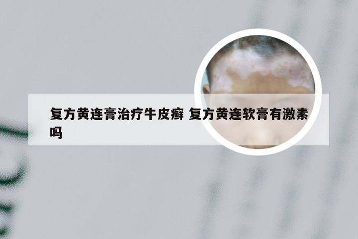 复方黄连膏治疗牛皮癣 复方黄连软膏有激素吗