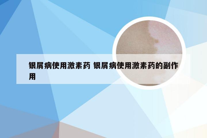 银屑病使用激素药 银屑病使用激素药的副作用