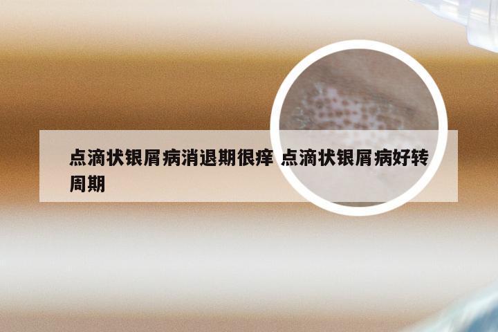 点滴状银屑病消退期很痒 点滴状银屑病好转周期