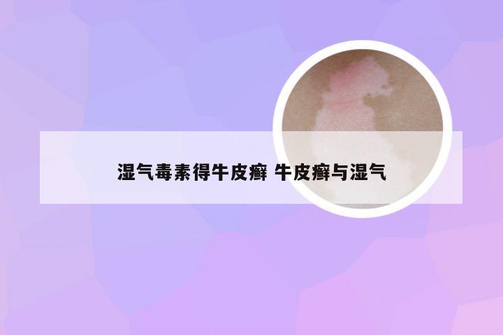湿气毒素得牛皮癣 牛皮癣与湿气