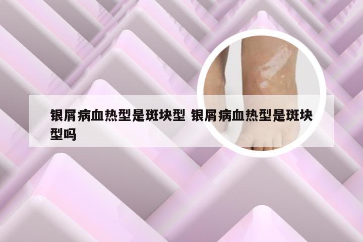 银屑病血热型是斑块型 银屑病血热型是斑块型吗