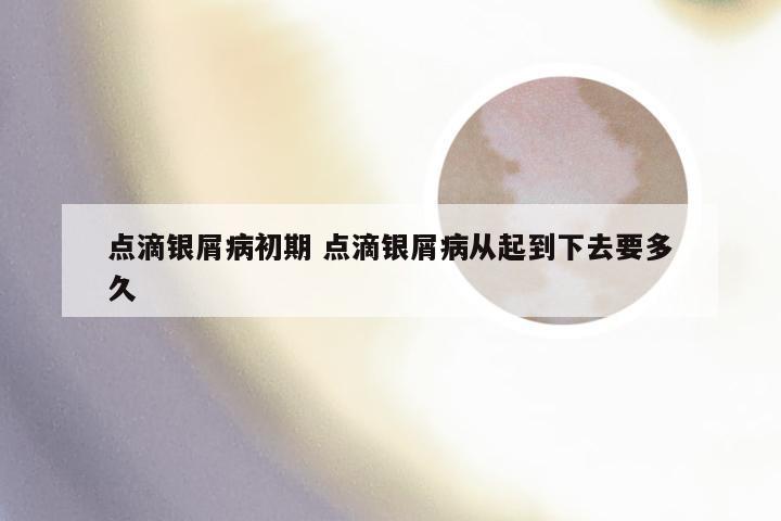 点滴银屑病初期 点滴银屑病从起到下去要多久