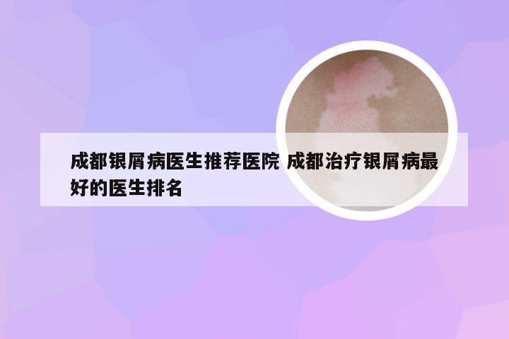 成都银屑病医生推荐医院 成都治疗银屑病最好的医生排名
