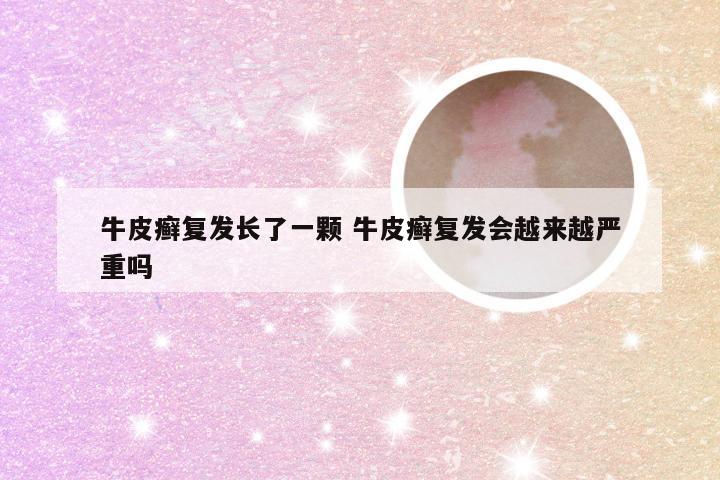 牛皮癣复发长了一颗 牛皮癣复发会越来越严重吗