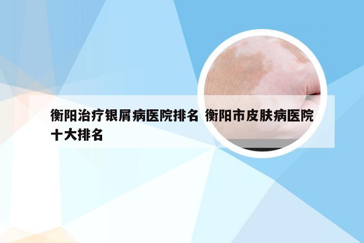 衡阳治疗银屑病医院排名 衡阳市皮肤病医院十大排名