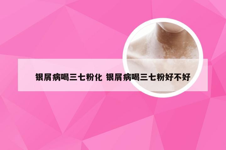 银屑病喝三七粉化 银屑病喝三七粉好不好