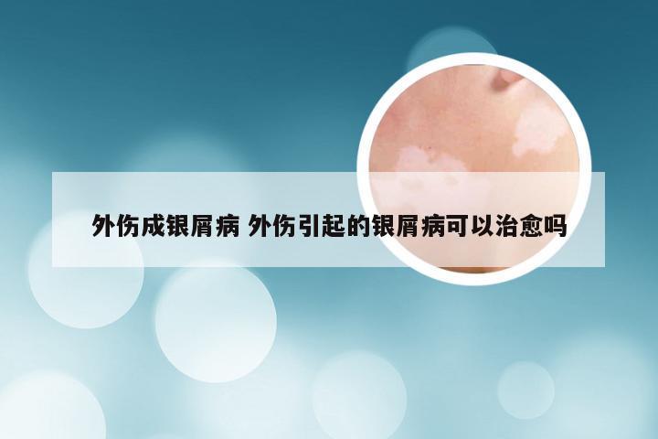 外伤成银屑病 外伤引起的银屑病可以治愈吗