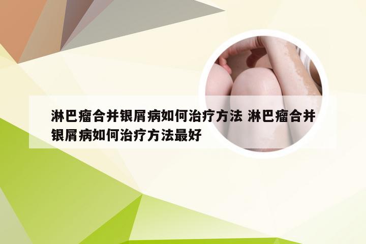 淋巴瘤合并银屑病如何治疗方法 淋巴瘤合并银屑病如何治疗方法最好