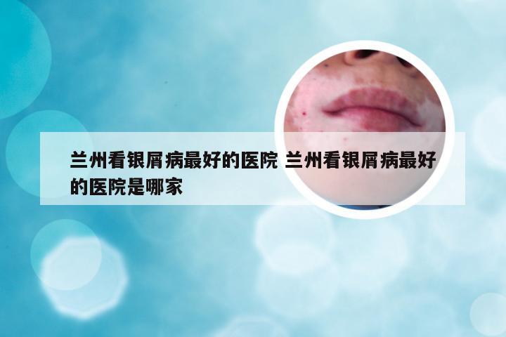 兰州看银屑病最好的医院 兰州看银屑病最好的医院是哪家