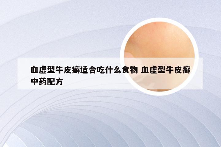 血虚型牛皮癣适合吃什么食物 血虚型牛皮癣中药配方