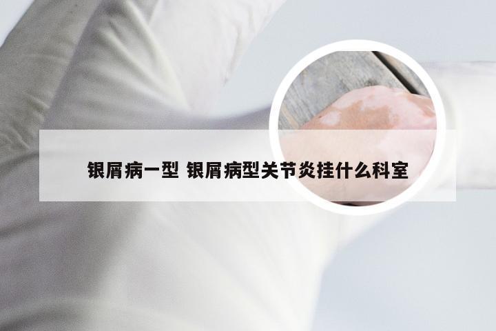 银屑病一型 银屑病型关节炎挂什么科室