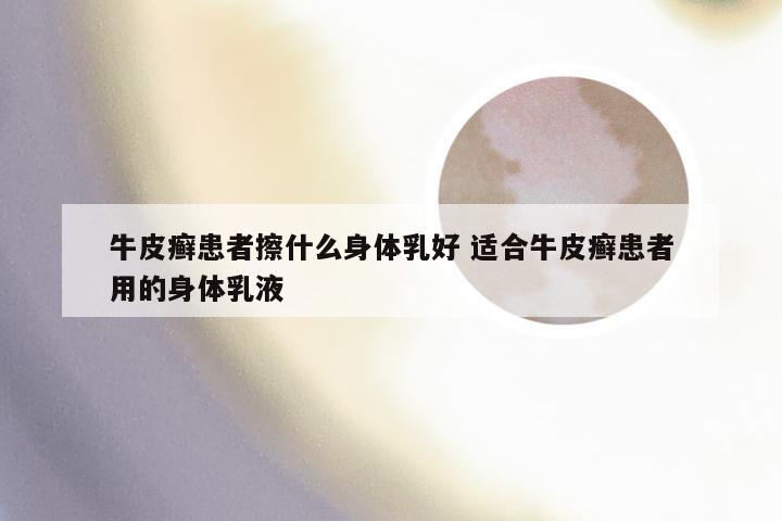 牛皮癣患者擦什么身体乳好 适合牛皮癣患者用的身体乳液