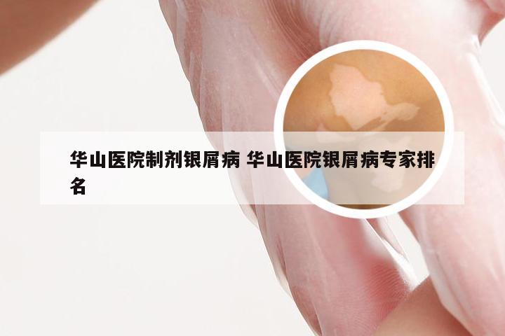 华山医院制剂银屑病 华山医院银屑病专家排名
