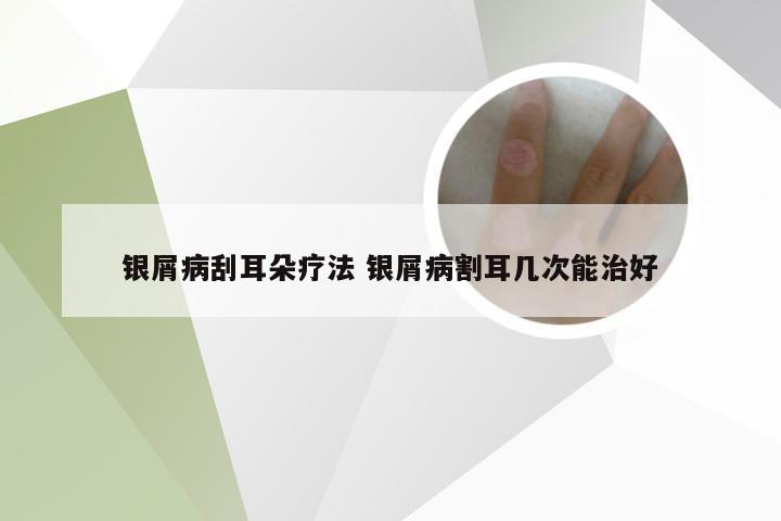 银屑病刮耳朵疗法 银屑病割耳几次能治好