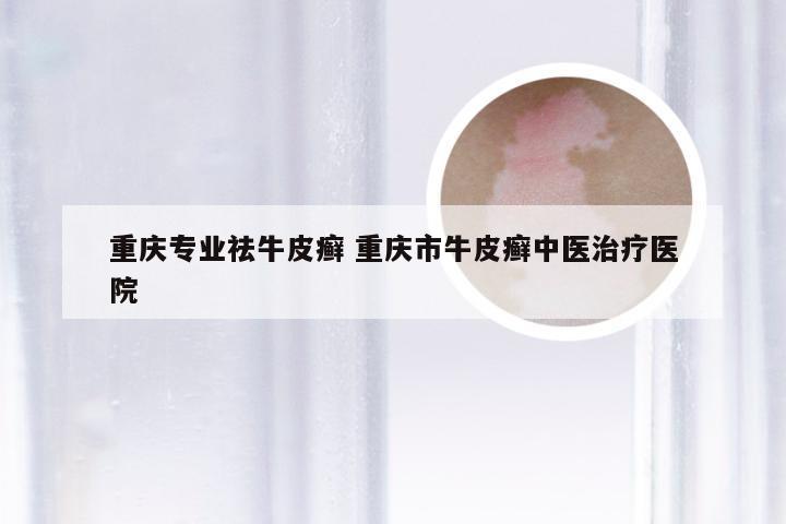 重庆专业祛牛皮癣 重庆市牛皮癣中医治疗医院