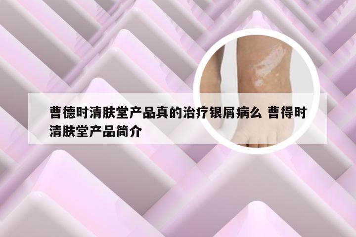 曹德时清肤堂产品真的治疗银屑病么 曹得时清肤堂产品简介
